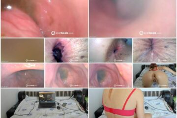 Sweet Tinqerbell - endoscope in my ass 2025-02-15 07 26