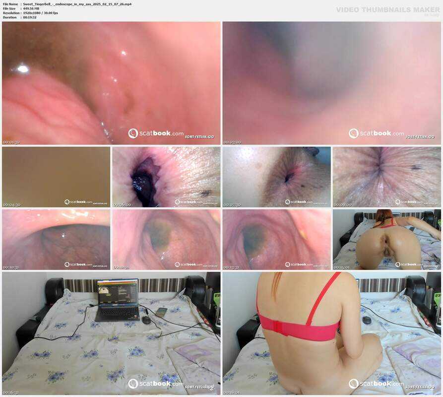 Sweet Tinqerbell - endoscope in my ass 2025 02 15 07 26