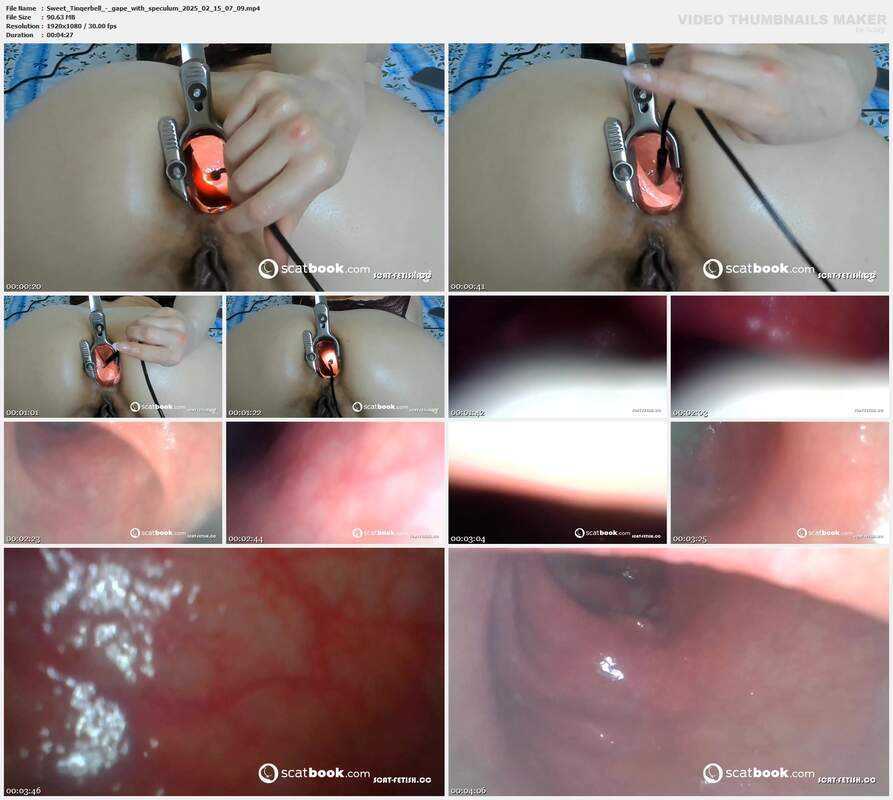 Sweet Tinqerbell - gape with speculum 2025 02 15 07 09