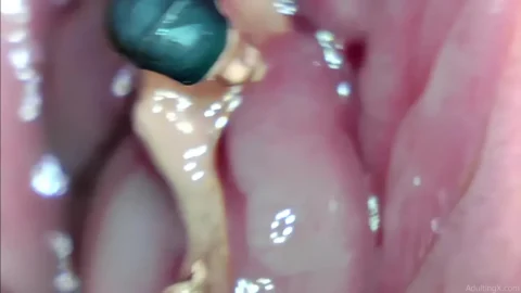 Unbirth Part